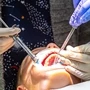Dental Fillings Inlays Onlays Services South Africa
