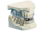 Mandibular Advancement Appliance Dentist South Africa