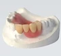 Acrylic Partial Denture Service In South Africa