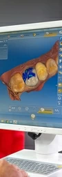 Dentists Port Elizabeth 3d Restoration In South Africa